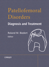 E-book, Patellofemoral Disorders : Diagnosis and Treatment, John Wiley & Sons
