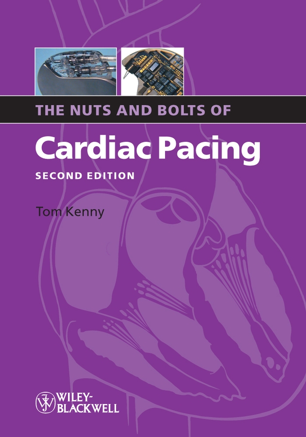 eBook, The Nuts and Bolts of Cardiac Pacing, Blackwell
