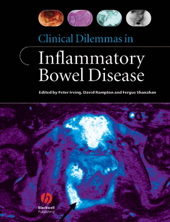 E-book, Clinical Dilemmas in Inflammatory Bowel Disease, Blackwell