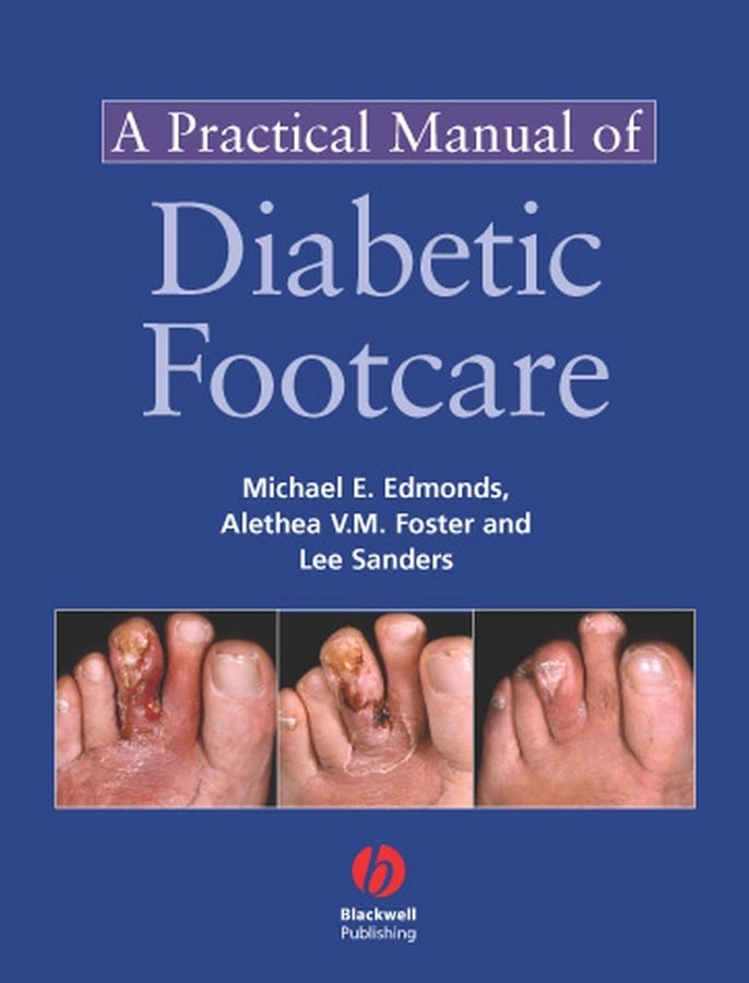 eBook, A Practical Manual of Diabetic Foot Care, Blackwell