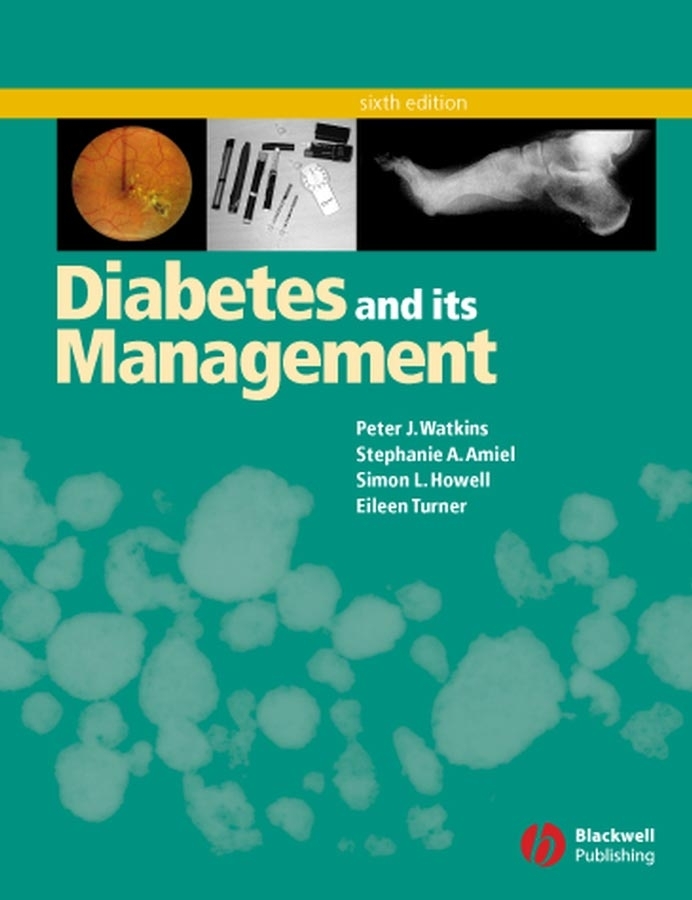 eBook, Diabetes and Its Management, Blackwell