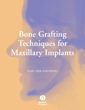 E-book, Bone Grafting Techniques for Maxillary Implants, Blackwell