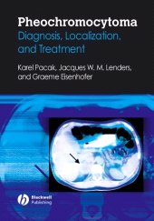 eBook, Pheochromocytoma : Diagnosis, Localization, and Treatment, Blackwell