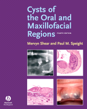E-book, Cysts of the Oral and Maxillofacial Regions, Blackwell