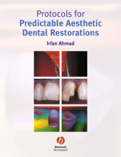 E-book, Protocols for Predictable Aesthetic Dental Restorations, Blackwell