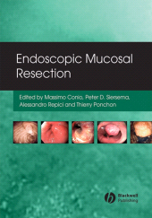 E-book, Endoscopic Mucosal Resection, Blackwell