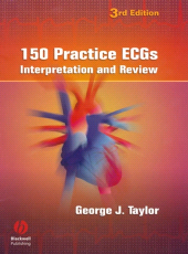 E-book, 150 Practice ECGs : Interpretation and Review, Blackwell