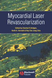 E-book, Myocardial Laser Revascularization, Blackwell