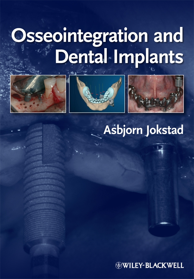 E-book, Osseointegration and Dental Implants, Blackwell