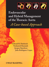 E-book, Endovascular and Hybrid Management of the Thoracic Aorta : A Case-based Approach, Blackwell