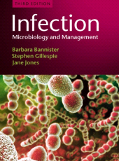 E-book, Infection : Microbiology and Management, Blackwell