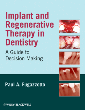 E-book, Implant and Regenerative Therapy in Dentistry : A Guide to Decision Making, Blackwell