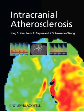 E-book, Intracranial Atherosclerosis, Blackwell