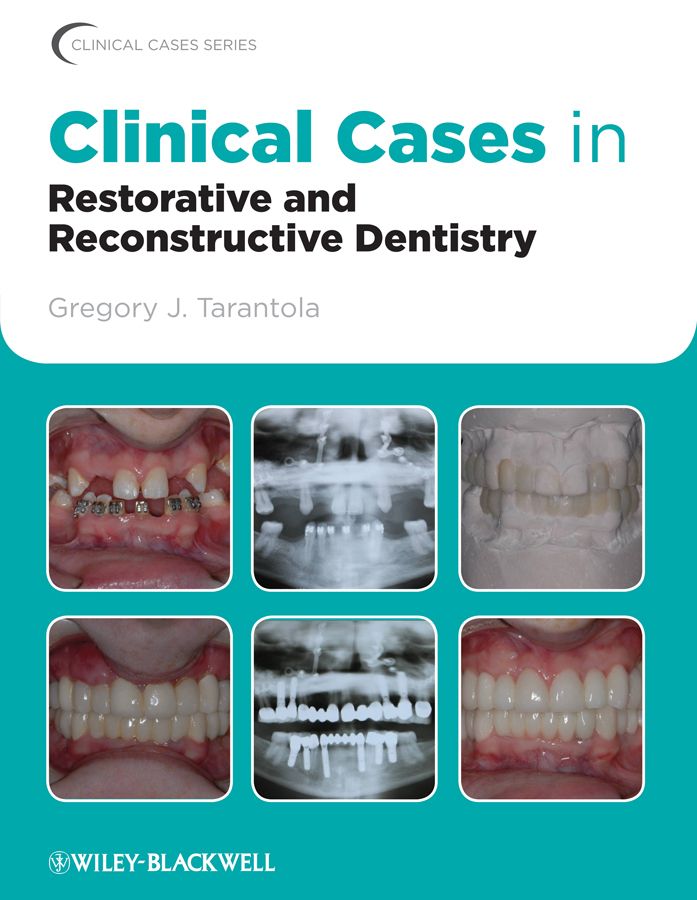 eBook, Clinical Cases in Restorative and Reconstructive Dentistry, Blackwell