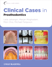 E-book, Clinical Cases in Prosthodontics, Blackwell
