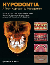 E-book, Hypodontia : A Team Approach to Management, Wiley