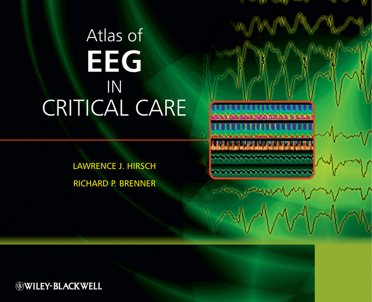 eBook, Atlas of EEG in Critical Care, John Wiley & Sons