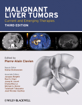 E-book, Malignant Liver Tumors : Current and Emerging Therapies, Blackwell