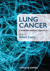 eBook, Lung Cancer : A Multidisciplinary Approach, Blackwell