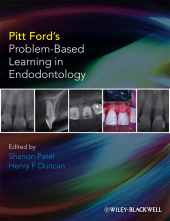 E-book, Pitt Ford's Problem-Based Learning in Endodontology, Blackwell