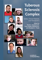 E-book, Tuberous Sclerosis Complex : Genes, Clinical Features and Therapeutics, Blackwell