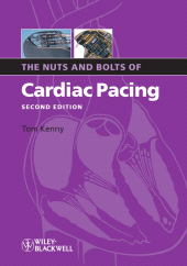 E-book, The Nuts and Bolts of Cardiac Pacing, Blackwell