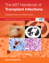 E-book, The AST Handbook of Transplant Infections, Blackwell