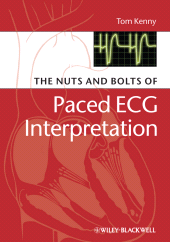 E-book, The Nuts and bolts of Paced ECG Interpretation, Blackwell