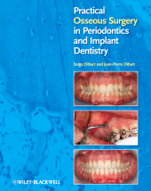 E-book, Practical Osseous Surgery in Periodontics and Implant Dentistry, Blackwell