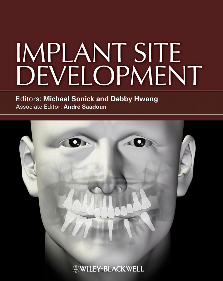 E-book, Implant Site Development, Blackwell
