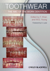 E-book, Toothwear : The ABC of the Worn Dentition, Blackwell