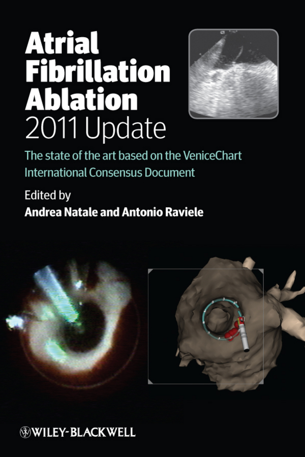 eBook, Atrial Fibrillation Ablation, 2011 Update : The State of the Art based on the VeniceChart International Consensus Document, Blackwell