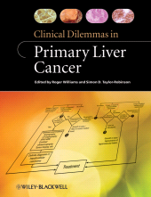 E-book, Clinical Dilemmas in Primary Liver Cancer, Blackwell