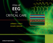 E-book, Atlas of EEG in Critical Care, Wiley
