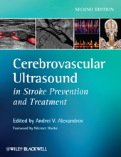 E-book, Cerebrovascular Ultrasound in Stroke Prevention and Treatment, Wiley