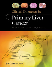 eBook, Clinical Dilemmas in Primary Liver Cancer, Wiley