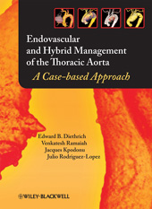 E-book, Endovascular and Hybrid Management of the Thoracic Aorta : A Case-based Approach, Wiley