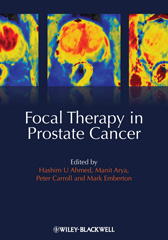 E-book, Focal Therapy in Prostate Cancer, Wiley