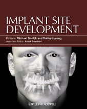 E-book, Implant Site Development, Wiley