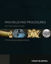 E-book, Pain-Relieving Procedures : The Illustrated Guide, Blackwell