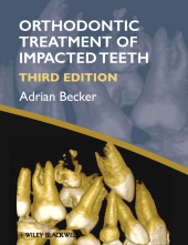 eBook, Orthodontic Treatment of Impacted Teeth, Blackwell