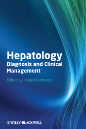 E-book, Hepatology : Diagnosis and Clinical Management, Blackwell
