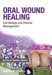 E-book, Oral Wound Healing : Cell Biology and Clinical Management, Blackwell