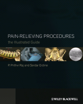 eBook, Pain-Relieving Procedures : The Illustrated Guide, Blackwell