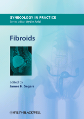 E-book, Fibroids, Blackwell