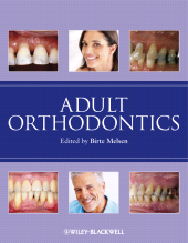 eBook, Adult Orthodontics, Blackwell