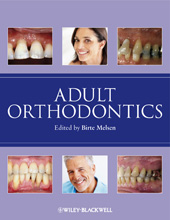 E-book, Adult Orthodontics, Wiley