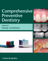 E-book, Comprehensive Preventive Dentistry, Wiley