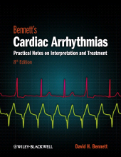 eBook, Bennett's Cardiac Arrhythmias : Practical Notes on Interpretation and Treatment, Wiley