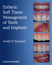 E-book, Esthetic Soft Tissue Management of Teeth and Implants, Wiley